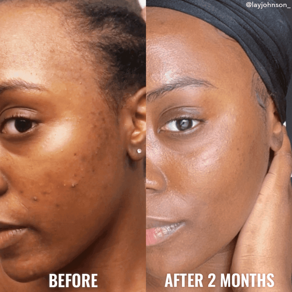 See a difference in your skin